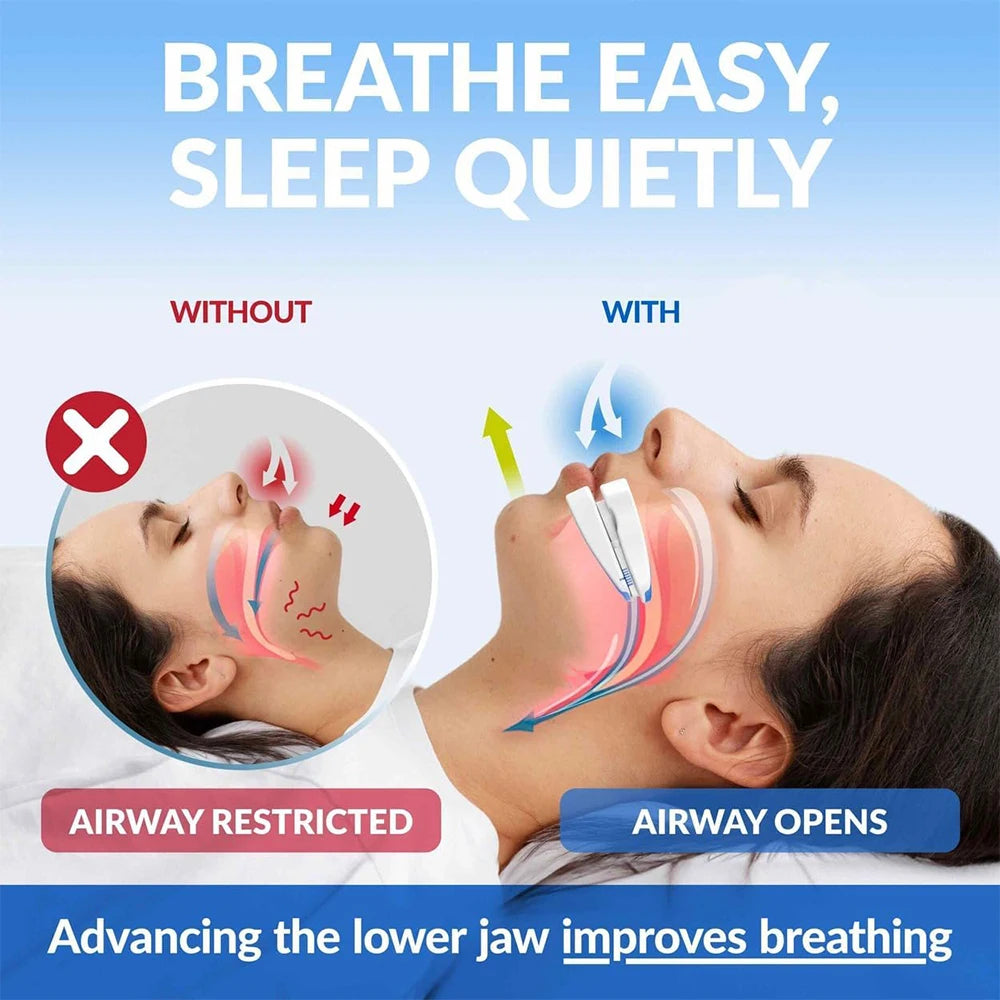 Silent Night Mouthguard